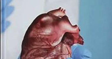 معهد الكبد القومى بالمنوفية يصدر كتاب دولى عن زراعة الأعضاء