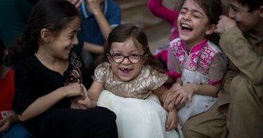 بالصور.. طفلة باكستانية تصاب بمرض وراثى نادر يعرقل نمو جسدها