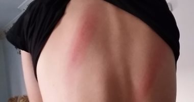 الضرب بالعصا جزاء طالب ذهب للحمام فى مدرسة ببنها.. والأب يحرر بلاغا