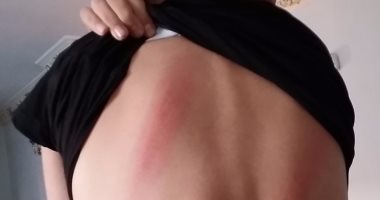 بالصور.. تفاصيل اعتداء مدير مدرسة فى بنها بالعصا على طالب لذهابه للحمام