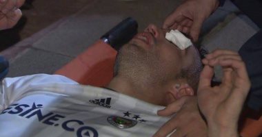 بالصور.. "العين عليها حارس".. فان بيرسى ينجو من الإصابة بالعمى بأعجوبة