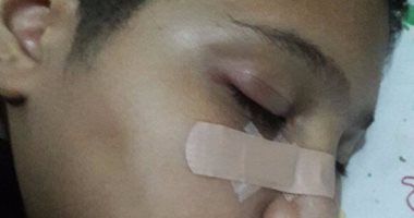 صحافة مواطن: شكوى من إهمال مدرسة العزيزية بالمريوطية