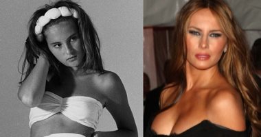 مفاجأة .. ميلانيا ترامب خضعت لـ4 عمليات تجميل.. شاهد صورها قبل وبعد