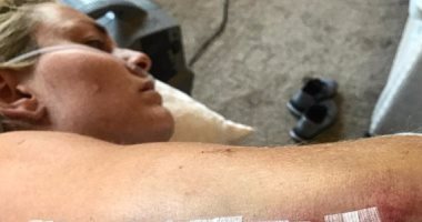 بالصور.. بطلة العالم للتزحلق على الجليد تتعرض لإصابة بشعة