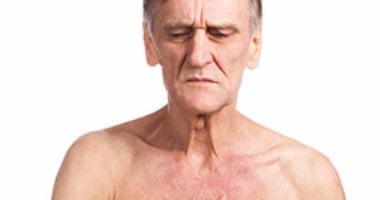 8 نصائح لتقى نفسك من مرض السرطان.. تعرف عليها 