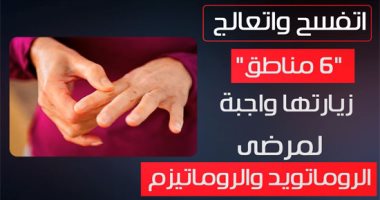 فيديو معلوماتى.. اتفسح واتعالج.. 6مناطق للاستشفاء من الروماتويد والروماتيزم
