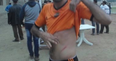 اشتباكات عنيفة بين لاعبى المنصورة ونبروه.. وإصابة لاعب بـ 8 غرز فى الرأس