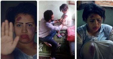 أبشع قصص العنف الزوجى.. "بثينة" فقدت رحمها بسبب اغتصابها من زوجها.. "فايقة" تاجر بجسدها وابنتها واصلت مسيرتها بعد سجنها.."سهام" حرقها لخروجها دون علمه.. و"مها" اشتراها رجل وتسبب فى مرضها وألقاها فى الشارع
