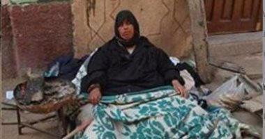 بالصور.. سمية تعانى من مرض الفيل والمستشفيات ترفض علاجها بسبب وزنها