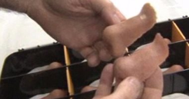 أنف صناعية ثلاثية الأبعاد تماثل أنف الكلب لاكتشاف الأمراض الخطيرة