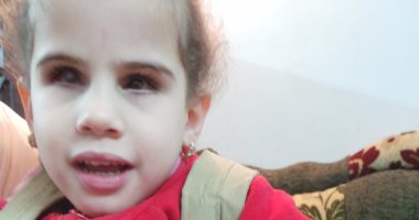 تغريم مستشفى خاص بالزقازيق 10 ملايين جنيه تعويضا عن فقد طفلين بصرهما