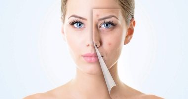 لماذا يتم التقشير الكيميائى على البشرة.. وهل له مخاطر؟