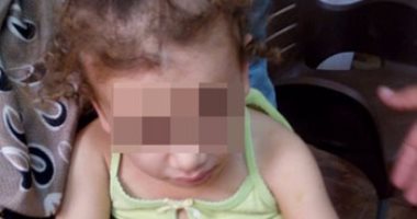 القومى للطفولة يتقدم ببلاغ للنائب العام فى واقعة اعتداء على طفلة بدمياط