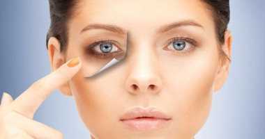 تخلصى من الهالات السوداء باستخدام البطاطس والشاى والحليب