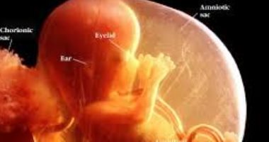 جنين عمره 36 أسبوعا أنقذ نفسه ووالدته من الموت