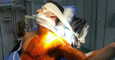 تعرف على سر الصورة المفزعة لأحمد سمير لاعب المصرى