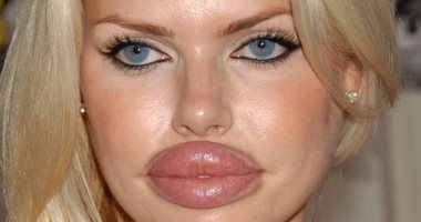 أسئلة يجب أن تجدى لها إجابة قبل إجراء عملية تجميل 