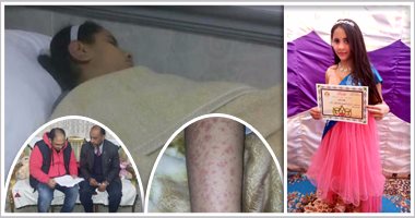 بالصور.. "الإهمال الطبى غول يلتهم أحلام البسطاء".. طفلة تدخل العناية المركزة بسبب خطأ ممرضة التأمين الصحى.. والد الضحية: بنتى غير قادرة على الحركة وأصيبت بطفح جلدى وتورم عقب تناولها التطعيم فى المدرسة