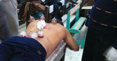 بالصور.. جمعية خيرية بالشرقية تستغل مدرسة لإجراء عمليات حجامة