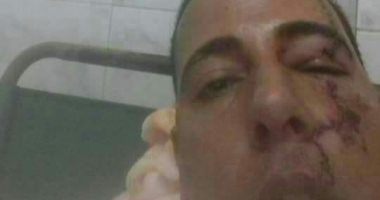 موزع قطع غيار سيارات يتهم أمين شرطة بطعنه بمطواة في جلسة عرفية بالشرقية