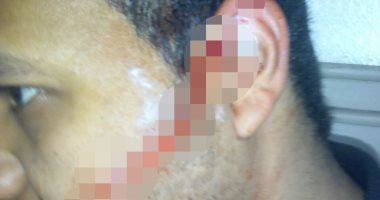 مسجل خطر يمزق وجه محصل كهرباء بموس فى مقر الشركة بسبب فاتورة بـ75جنيها 