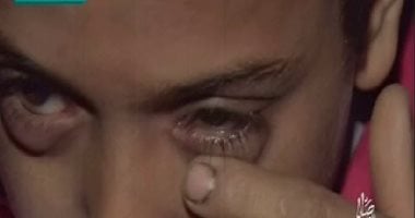 بالفيديو.. طفل يخرج "زلط" من عينيه مع ريهام سعيد