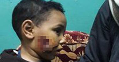 بالفيديو والصور.. الحيوانات الضالة تهدد أهالى الفيوم.. والمستشفى العام:50 شخصا يعقرون يوميًا