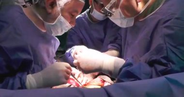مدير وحدة زراعة الأعضاء بجامعة الزقازيق: زراعة أكثر من 3 آلاف كبد بمصر