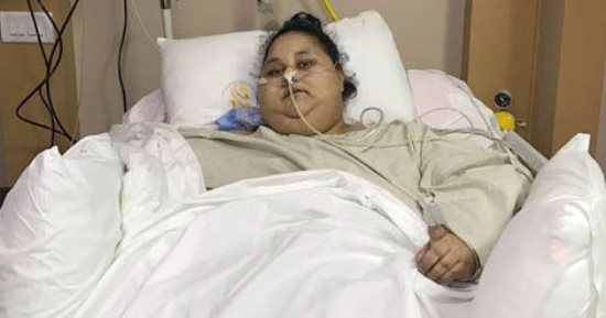 تفاصيل تجهيز مستشفى برجيل الإمارتية لنقل أسمن امرأة من الهند لأبو ظبى