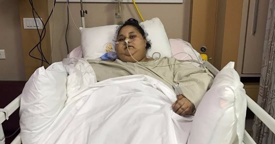 "صحة البرلمان" تتواصل مع السفارة المصرية بالهند للاطمئنان على "أسمن امرأة"