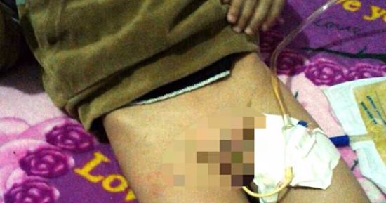 أسرة طفل بالبحيرة تتهم معلمة بالتعدى عليه وتصيبه بنزيف فى عضوه الذكرى