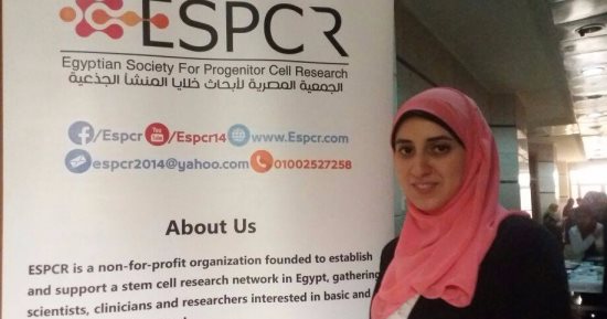 تقنية جديدة لعلاج سرطان المثانة بالخلايا الجذعية