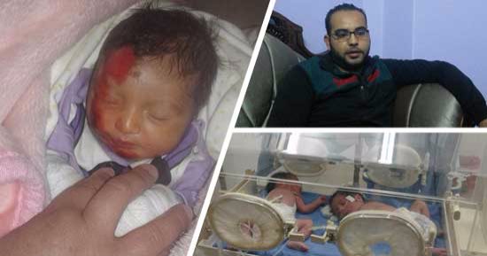 بالفيديو والصور.. احتراق مولودة داخل مستشفى خاص ببنى سويف آخر حلقات الإهمال الطبى.. دخلت الحضانة لشفط المياه والتدفئة وخرجت مصابة بحروق من الدرجتين الثانية والثالثة.. وصحة بنى سويف تقرر إغلاق الحضانة