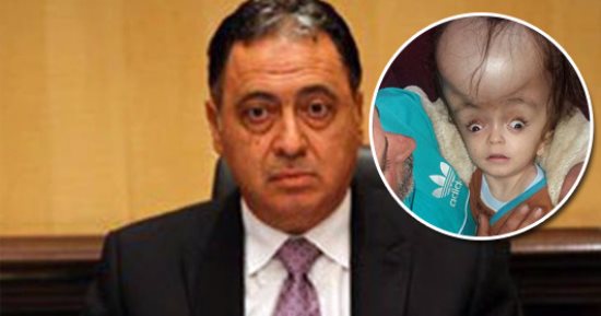 بالصور.. رأس الطفل "يوسف" على وشك الانفجار بسبب مرض.. ووالده يستغيث بوزير الصحة لإنقاذ حياته.. المستشفى حدد موعدا للفحص بعد شهرين "وكله بالدور".. والأطباء طالبوه بشراء جهاز قيمته 3600 جنيه