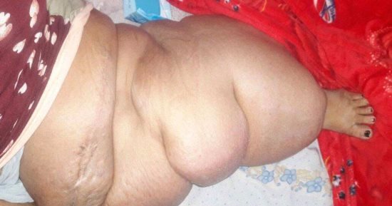 بالفيديو والصور.. سيدة بأسيوط وزنها تعدى 300 كيلو ولا تتحرك منذ 3 سنوات