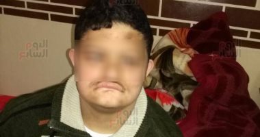 معاق ذهنيا بالدقهلية عن اغتصابه على يد 3 أشخاص: "قالولى فيه فرح"