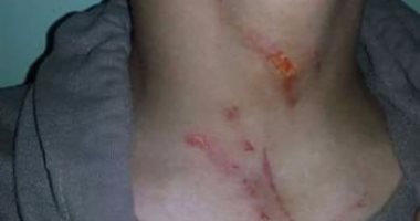 إحالة مدير مدرسة ثانوى بدمياط للتحقيق لاعتدائه بالضرب على طالب
