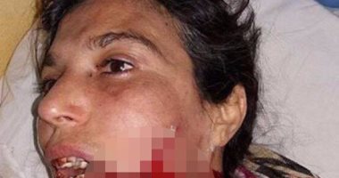 جزار يشق فم جارته بالسكين فى المنوفية لمنعها من بيع الأنابيب أمام منزلها