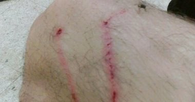 طالب بالمدينة الجامعة بأزهر أسيوط يشكو انتشار الكلاب المسعورة