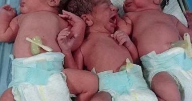 سيدة تضع ثلاثة توائم بمركز الإخصاب المساعد بقنا الجامعى