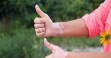 حقائق مرتبطة بأمراض المناعة الذاتية كل امرأة معرفتها