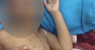 بالصور.. المتهم بتعذيب ابن زوجته: حرقت عضوه الذكرى وخلعت أظافره عشان يتأدب