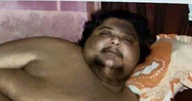 بعد تجربة إيمان أسمن امرأة.. جراحة ناجحة لأسمن رجل فى مصر يزن 450 كيلو