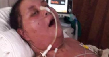 شقيقة أسمن امرأة: أطباء الهند يعاملوننا كفئران تجارب ونستعد للسفر لأبوظبى