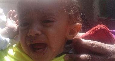 رضيع بين الحياة والموت يحتاج زراعة كلى بسبب التكيسات