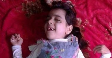 طفلة تعانى ضمورا بالمخ وصرعا.. والأم تناشد الحكومة لعلاجها على نفقة الدولة