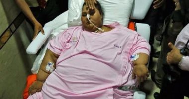 أسمن امرأة تعانى من مشاكل بالكلى والكبد وقد تظل عاما بالإمارات للشفاء 