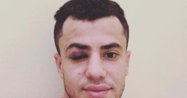 الونش يتعرض لكدمة فى العين قبل موقعة كابس يونايتد