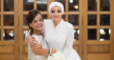 بالصور.. صاحبة أجمل ضحكة على إنستجرام مصطلح "قزمة" لقب خارج قاموسها