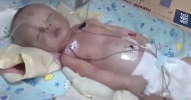 بسبب حاسة الشم.. كلب ينقذ طفلا من الموت بعد دفنه حيا بالصين
